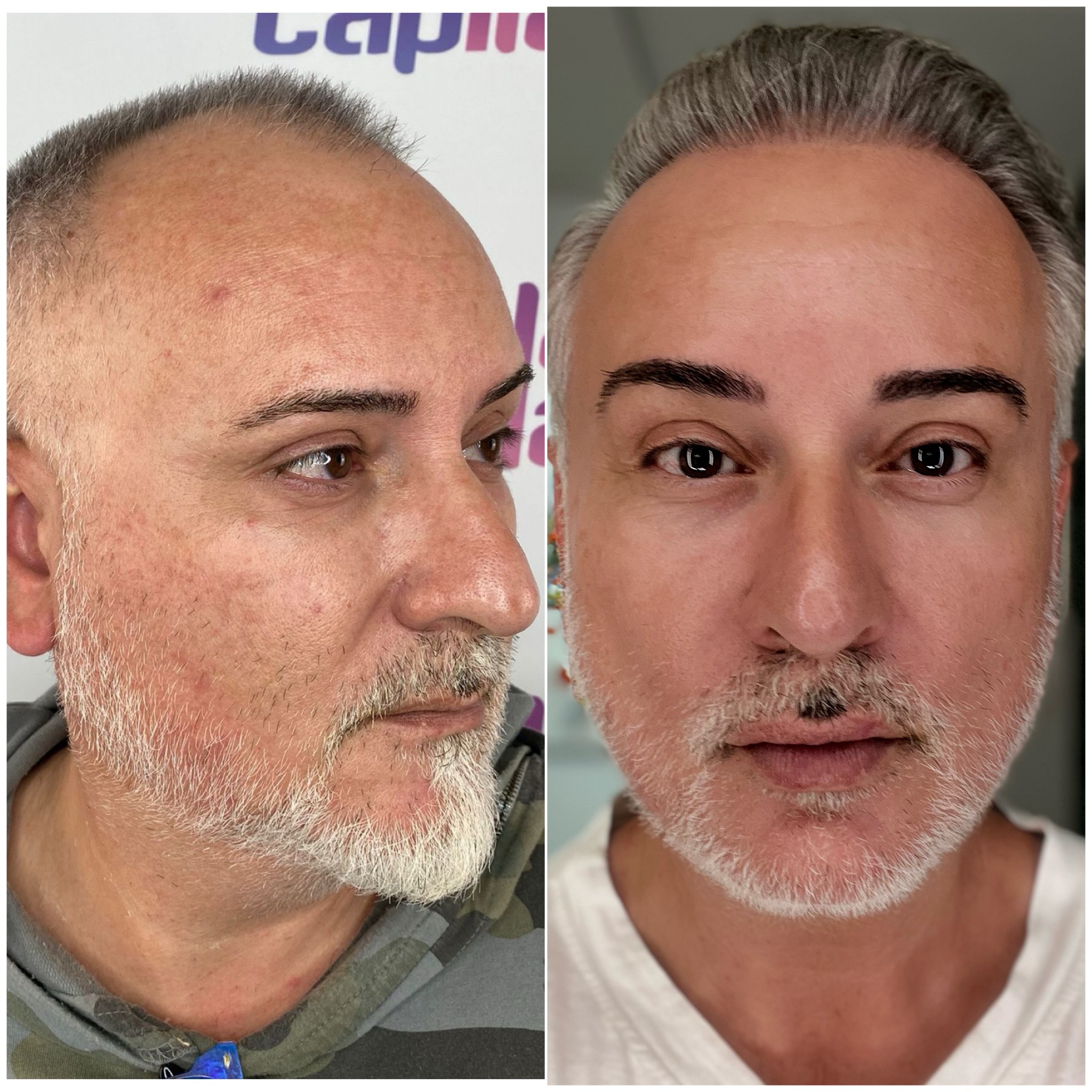 Comparativa personal de Paco Navarro: textura y aspecto de la piel
