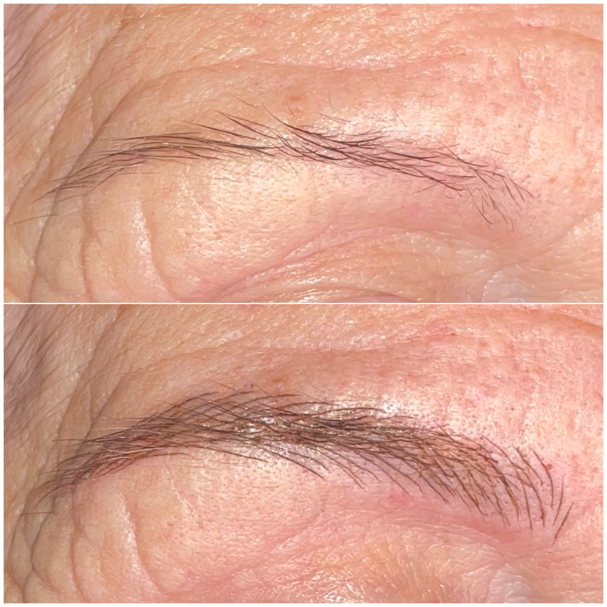 Cejas · Recuperar el arco